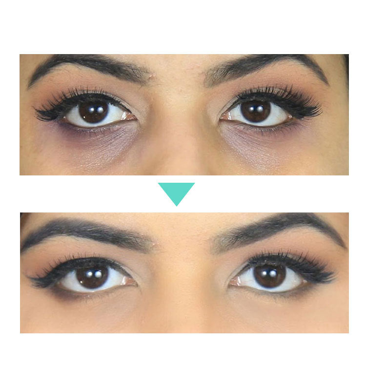 Cooling Under-Eye Gel Pads