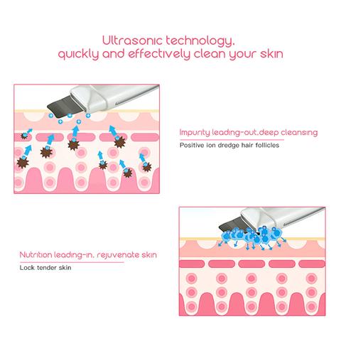 Ultrasonic Facial Skin Scrubber